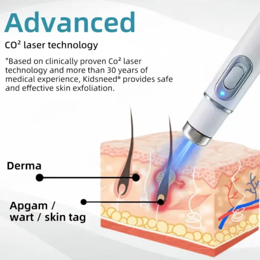 Remifa® Non-invasive Mole & Wart Removal Laser Pen